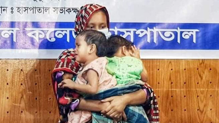 সোমবার অস্ত্রোপচার জোড়াশিশু লাবিবা ও লামিসার